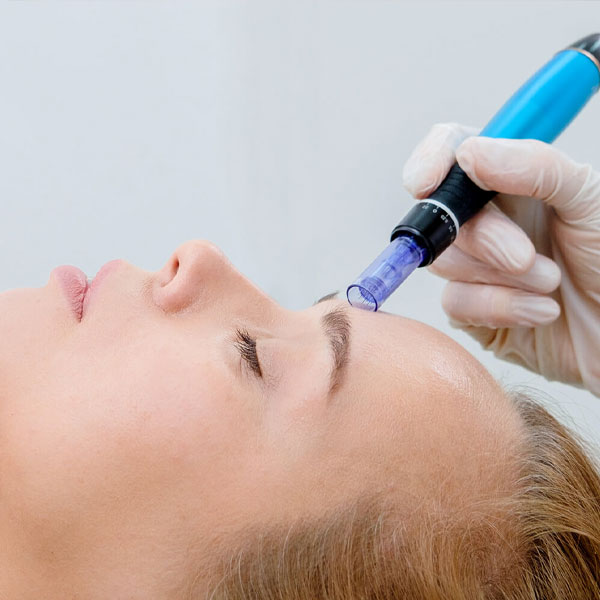 Hyaluronic Acid Collagen Induction Therapy